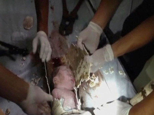 (Video) Así fue el rescate de bebé arrojado a un water en China