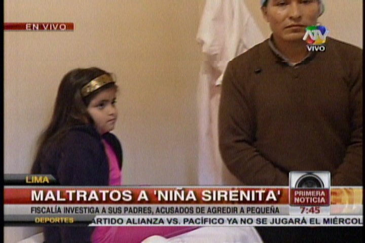 (ATV) Padres de la niña "Sirenita" niegan maltratos y culpan a enfermera de Castañeda