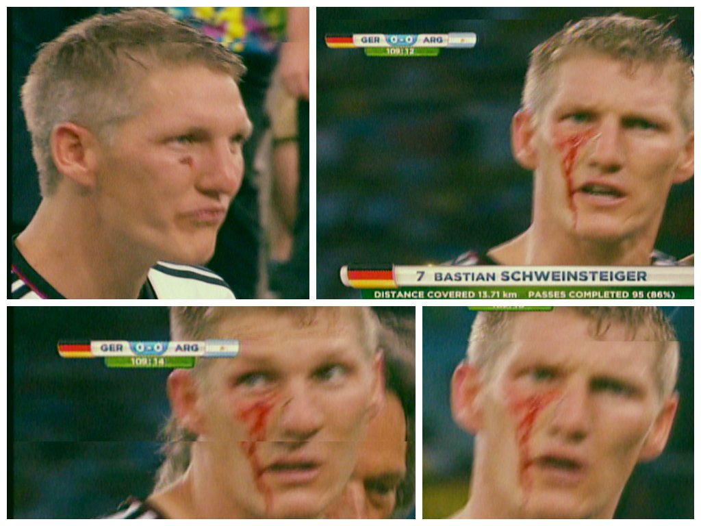 [FOTOS] Schweinsteiger, sangra el rostro del campeón alemán de Brasil 2014