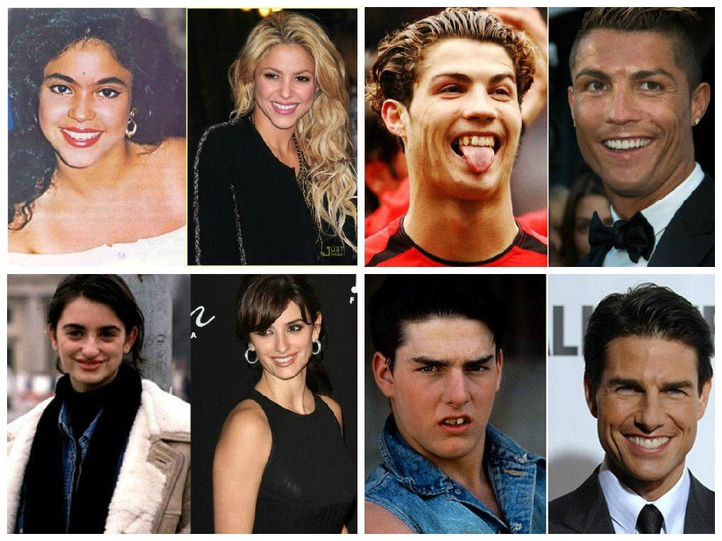 Shakira, Ronaldo y más...así eran antes estos famosos [FOTOS]