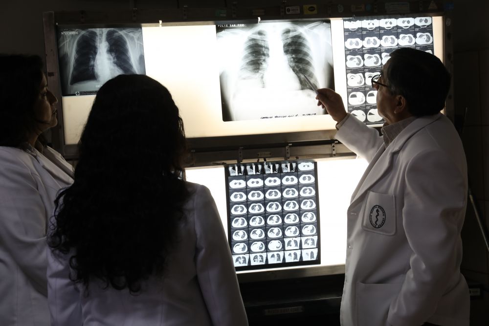 Casos de tuberculosis en el Perú