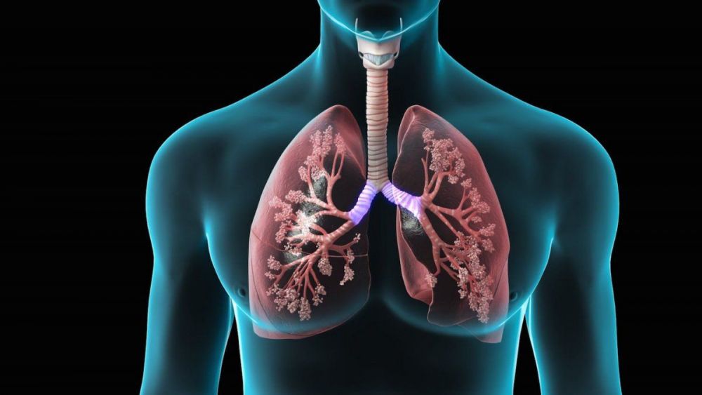 Hipertensión Arterial Pulmonar